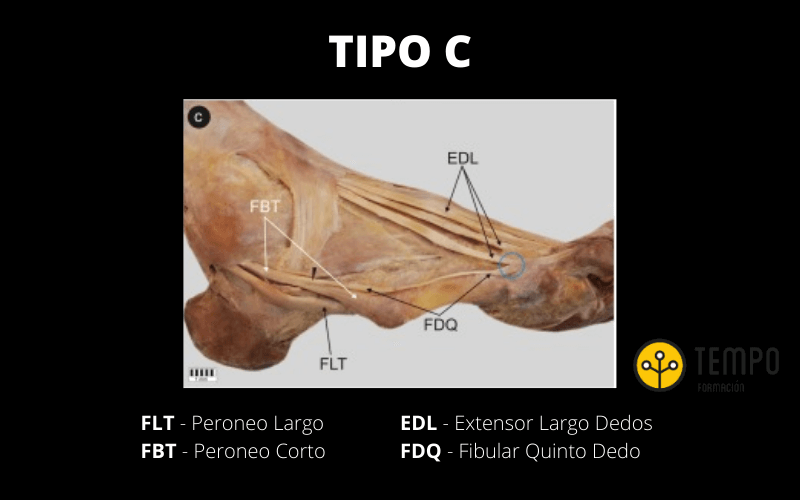 Tipo C.png